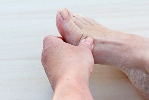 arthritis of the foot