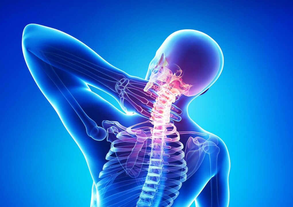 Neck osteochondrosis