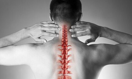 How does osteochondrosis of the cervical spine manifest