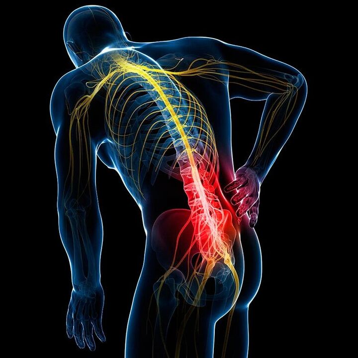 back pain causes