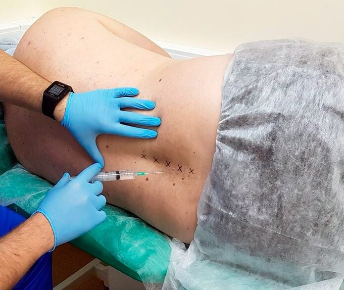 medicinal blockages for the back